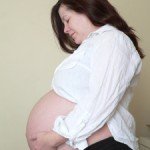 My singleton pregnancy at 37 weeks